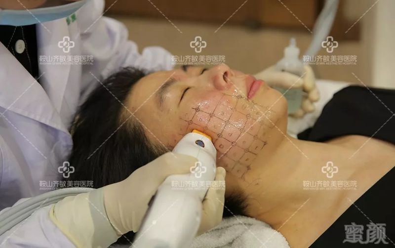 https://img.miyanlife.com/mnt/timg/180830/1039425U9-5.jpg
