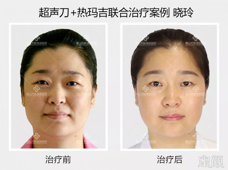 https://img.miyanlife.com/mnt/timg/180830/103942N15-6.jpg