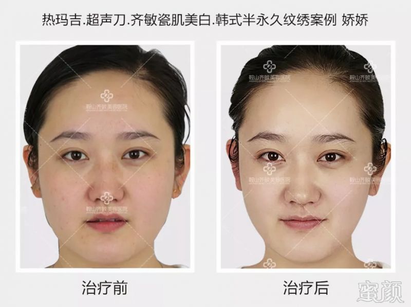 https://img.miyanlife.com/mnt/timg/180830/1039431A6-7.jpg