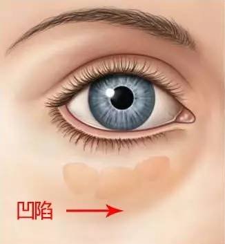 https://img.miyanlife.com/mnt/timg/180830/1041211035-5.jpg