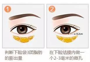 https://img.miyanlife.com/mnt/timg/180830/10412112L-3.jpg