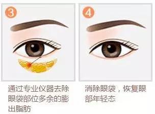https://img.miyanlife.com/mnt/timg/180830/1041214628-4.jpg
