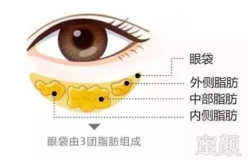 https://img.miyanlife.com/mnt/timg/180830/1041215430-1.jpg