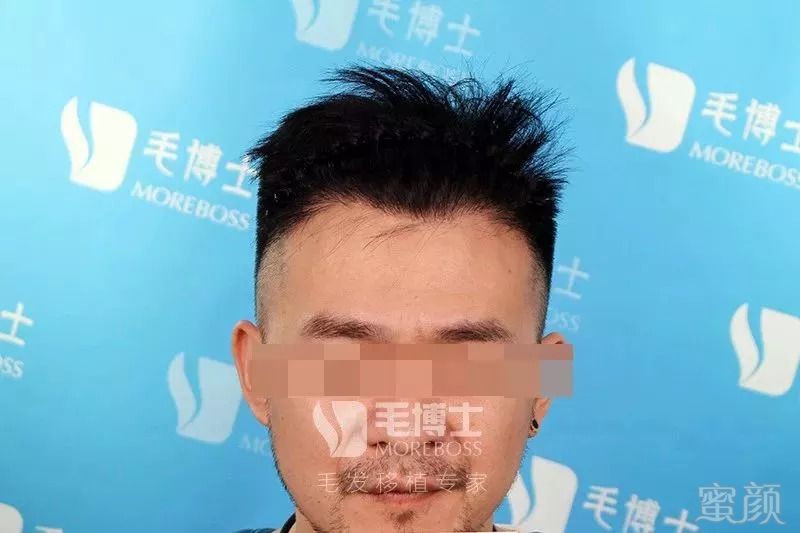 https://img.miyanlife.com/mnt/timg/180830/10533T4M-3.jpg