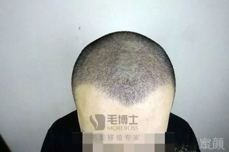 https://img.miyanlife.com/mnt/timg/180830/10533T542-2.jpg