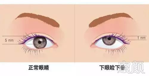 https://img.miyanlife.com/mnt/timg/180830/110J05951-6.jpg