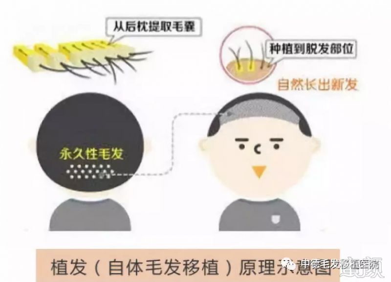 https://img.miyanlife.com/mnt/timg/180830/110Z5A94-0.jpg