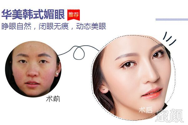 https://img.miyanlife.com/mnt/timg/180830/11304CY4-8.jpg