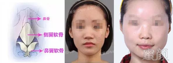 https://img.miyanlife.com/mnt/timg/180830/113130B16-3.jpg
