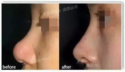 https://img.miyanlife.com/mnt/timg/180830/113132O14-5.jpg