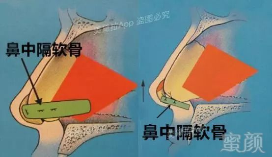 https://img.miyanlife.com/mnt/timg/180830/113134B91-10.jpg