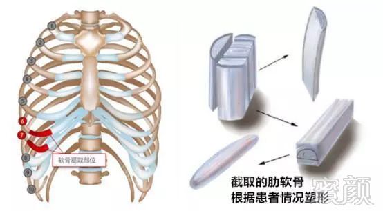 https://img.miyanlife.com/mnt/timg/180830/1131353P4-12.jpg