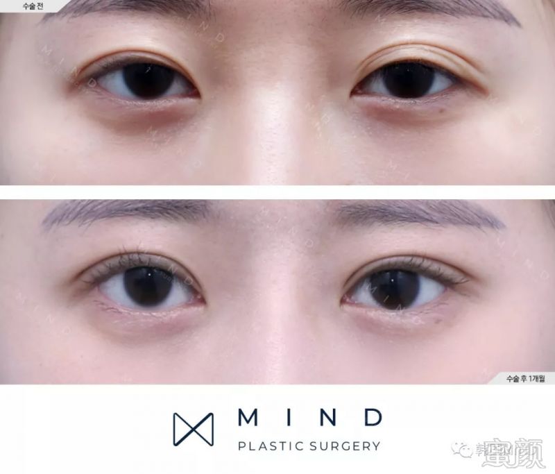 https://img.miyanlife.com/mnt/timg/180830/11320IM3-3.jpg