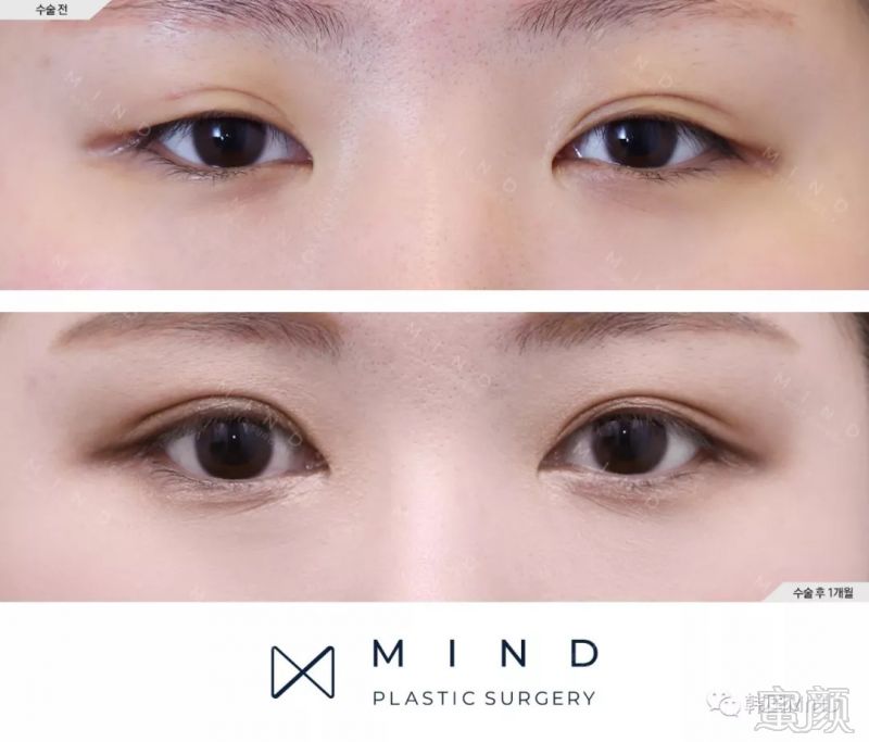 https://img.miyanlife.com/mnt/timg/180830/11320T404-4.jpg