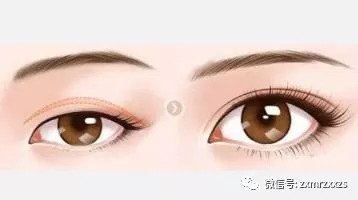 https://img.miyanlife.com/mnt/timg/180830/1132202451-1.jpg