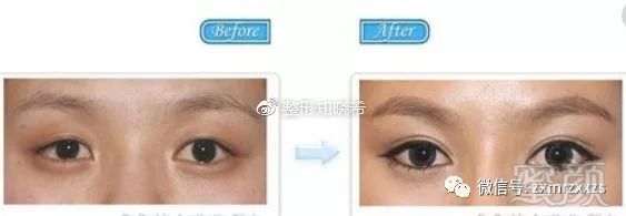 https://img.miyanlife.com/mnt/timg/180830/1132212054-2.jpg