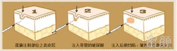 https://img.miyanlife.com/mnt/timg/180830/1139493048-12.jpg
