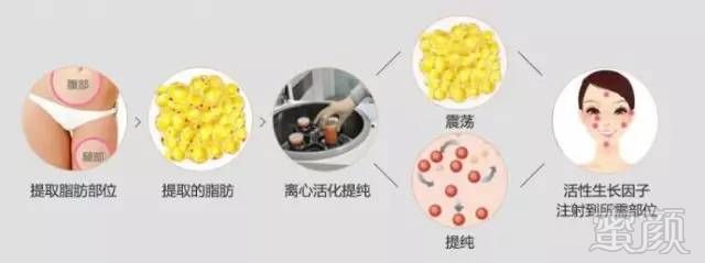 https://img.miyanlife.com/mnt/timg/180830/11394VO7-6.jpg