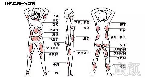 https://img.miyanlife.com/mnt/timg/180830/11394WP1-5.jpg