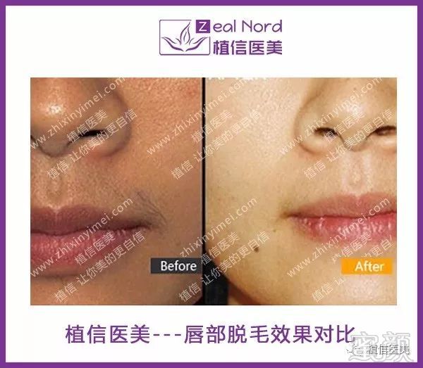 https://img.miyanlife.com/mnt/timg/180830/113F11293-4.jpg