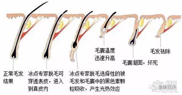 https://img.miyanlife.com/mnt/timg/180830/113F1GA-3.jpg