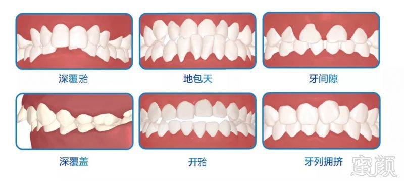 https://img.miyanlife.com/mnt/timg/180830/1144595Y1-6.jpg