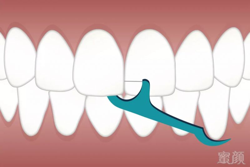 https://img.miyanlife.com/mnt/timg/180830/1145042514-8.jpg