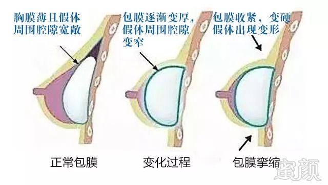 案例图片