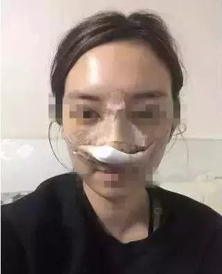 https://img.miyanlife.com/mnt/timg/180830/1156463a6-5.jpg