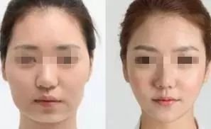 https://img.miyanlife.com/mnt/timg/180830/115Q94a0-13.jpg