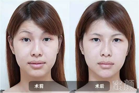 https://img.miyanlife.com/mnt/timg/180830/115QVM4-11.jpg