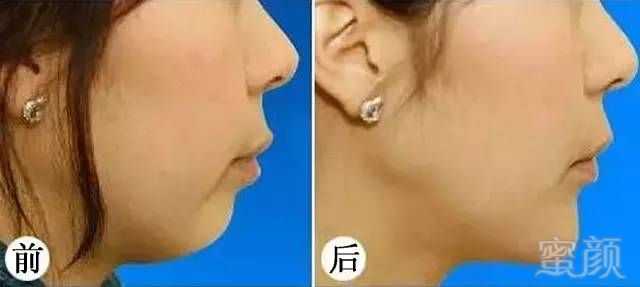 https://img.miyanlife.com/mnt/timg/180830/115QW940-9.jpg