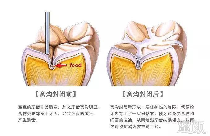 案例图片