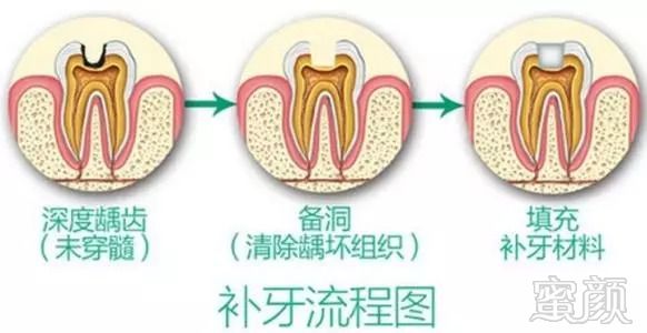 案例图片