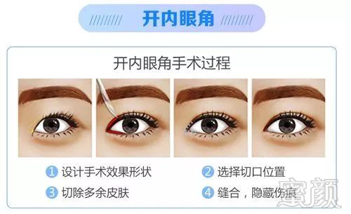 https://img.miyanlife.com/mnt/timg/180830/12030115D-2.jpg