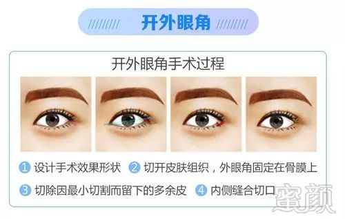 https://img.miyanlife.com/mnt/timg/180830/1203014504-3.jpg