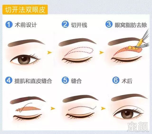 https://img.miyanlife.com/mnt/timg/180830/120301DW-1.jpg