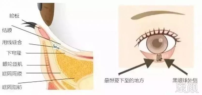 https://img.miyanlife.com/mnt/timg/180830/120301E19-4.jpg