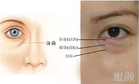 https://img.miyanlife.com/mnt/timg/180830/1203023112-6.jpg