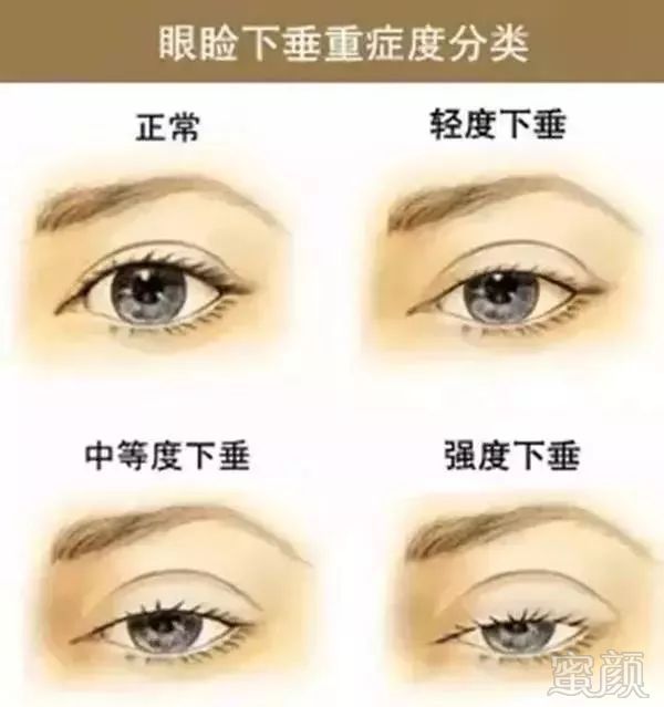https://img.miyanlife.com/mnt/timg/180830/1203025541-5.jpg