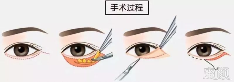 https://img.miyanlife.com/mnt/timg/180830/1203026007-8.jpg