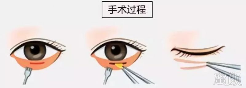 https://img.miyanlife.com/mnt/timg/180830/120302O01-7.jpg