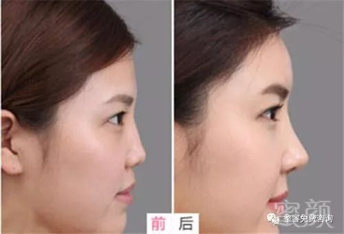 https://img.miyanlife.com/mnt/timg/180830/120U46222-2.jpg