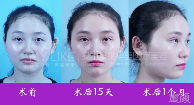 https://img.miyanlife.com/mnt/timg/180830/1214344607-1.jpg