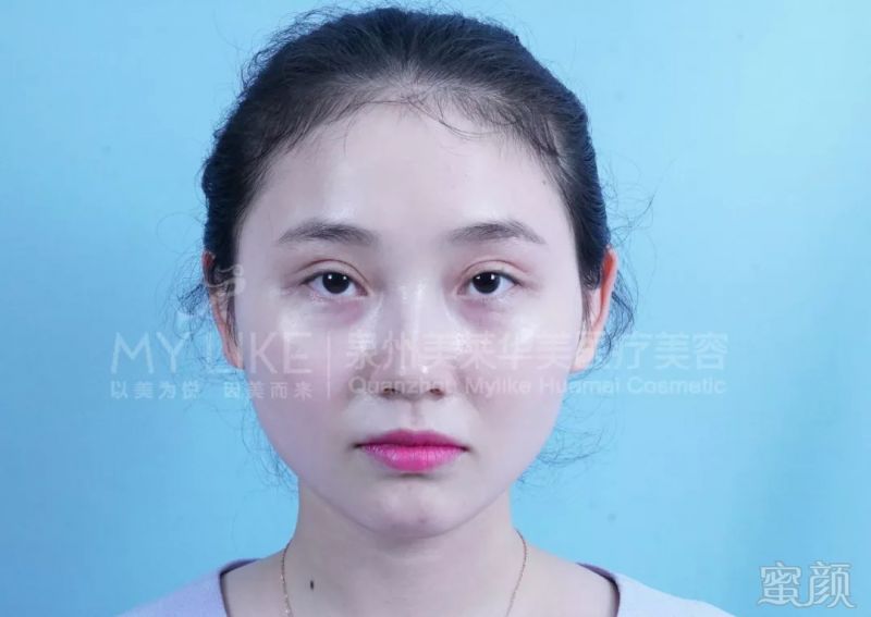 https://img.miyanlife.com/mnt/timg/180830/1214355Q0-3.jpg