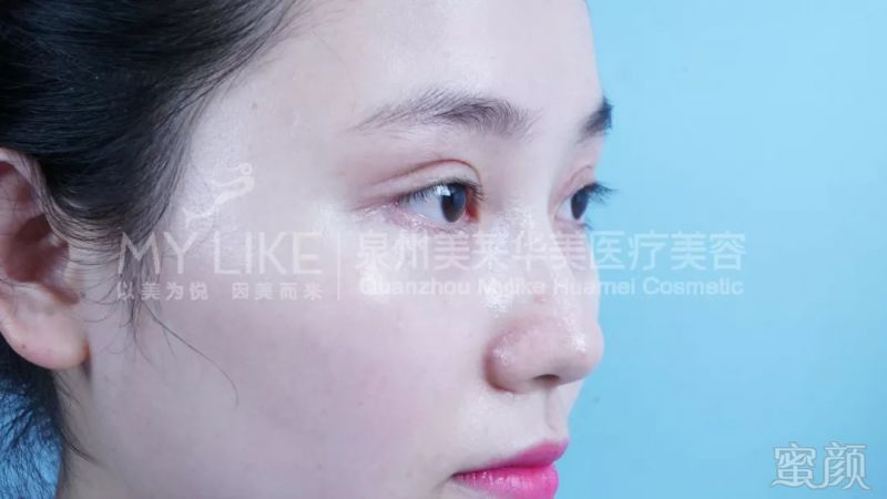 https://img.miyanlife.com/mnt/timg/180830/1214363436-5.jpg