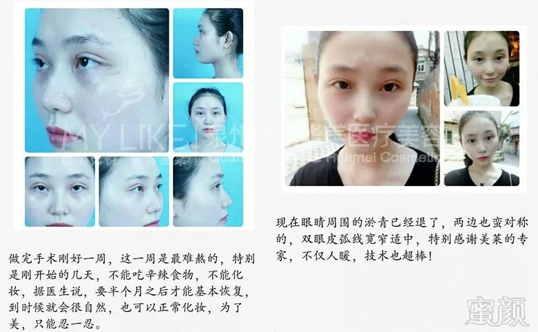 https://img.miyanlife.com/mnt/timg/180830/12143J0W-10.jpg