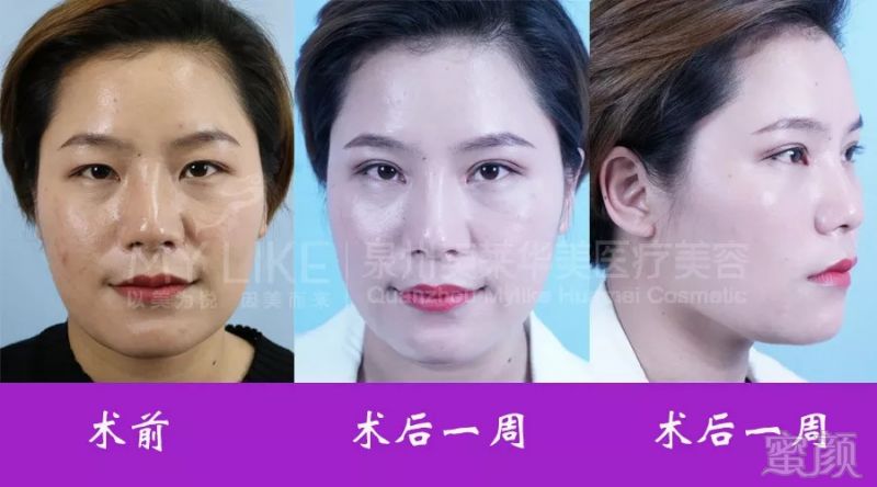 https://img.miyanlife.com/mnt/timg/180830/12143M017-11.jpg