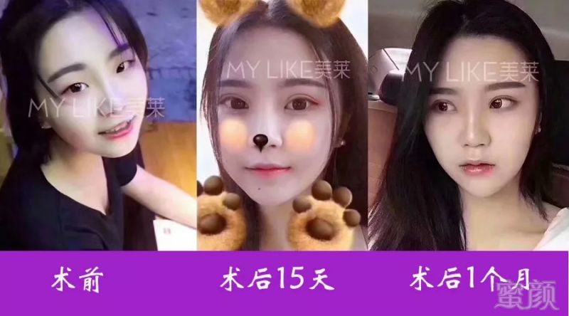 https://img.miyanlife.com/mnt/timg/180830/12143V251-12.jpg