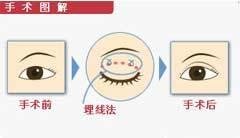 案例图片